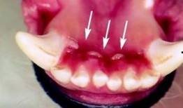 吃瓜牙龈流血,揭秘吃瓜者的牙龈健康之谜